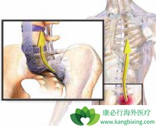 �ܽ��׵õĲ����İ�֢��ǿֱ�Լ����׻���