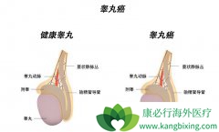 �����������غ�谩֢״����Щ