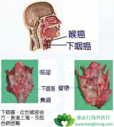 �����ʺ���֢״�������п�������˻�Ƶ�