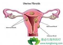 �˽������ӹ���֢״���ܾ��緢�־�������