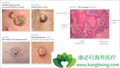 ���������⻹����������������Ƥ����֢״