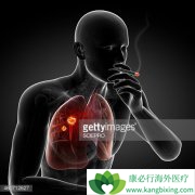 �ΰ�����֢״�ȷΰ�������֢״��������