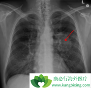 �ΰ���ת�ƿ���ʹ�÷��Ӱ���ҩ��������