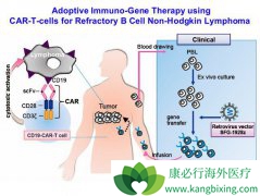 CAR-T�Ʒ�ΪѪҺ���������ƴ�������ϣ��